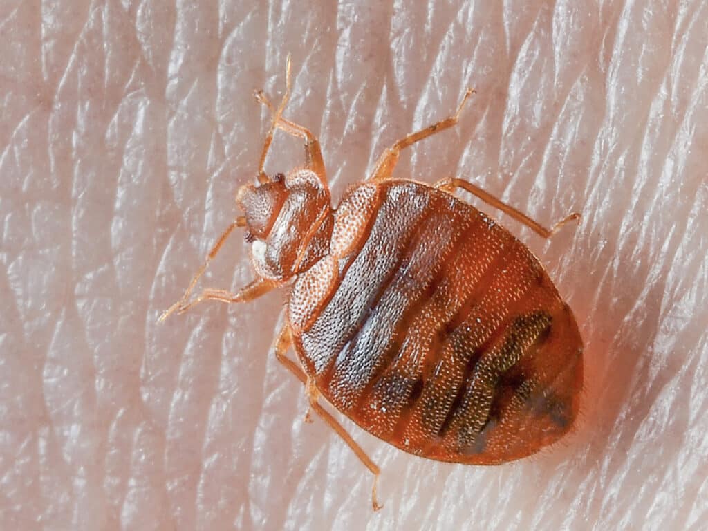 bed bug bites