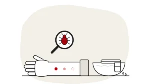 Illustration of a forearm with fading bed bug bites and a bowl with a damp cloth, with a bed bug under a magnifying glass
